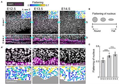 Incoherent Feedforward Regulation via Sox9 and ERK Underpins Mouse Tracheal Cartilage Development